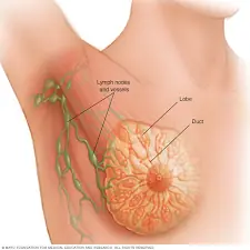 BREAST CANCER